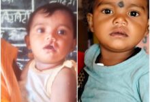 शासन की योजना से दूर हुई बेटी के भविष्य की चिंता, चिरायु दल ने लौटाई मासूम रंजना की मुस्कान…