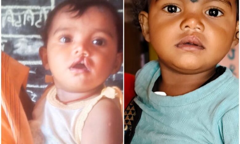 शासन की योजना से दूर हुई बेटी के भविष्य की चिंता, चिरायु दल ने लौटाई मासूम रंजना की मुस्कान… शासन की योजना से दूर हुई बेटी के भविष्य की चिंता, चिरायु दल ने लौटाई मासूम रंजना की मुस्कान…